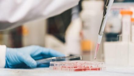 细胞培养，选择培养瓶还是培养皿？